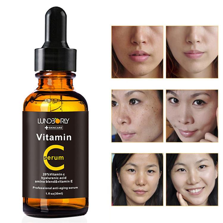 LUNDBORLY Vitamina C Vitamina E Ser Ser cu Vitamina C