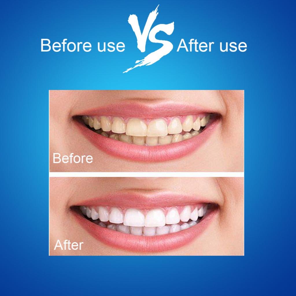 Teeth Whitening Strips 14 Treatments, Enamel Safe for Instant White Smile, Easy To Apply Tooth Whitening Kit with 28 Strips (14 Upper & 14 Lower)