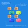 Smiling Steamed Bun Stress Ball Anti-Anxiety Cartoon Dumpling Squeeze Toy Soft Simulated Dough Ball Fidget Sensory Toy