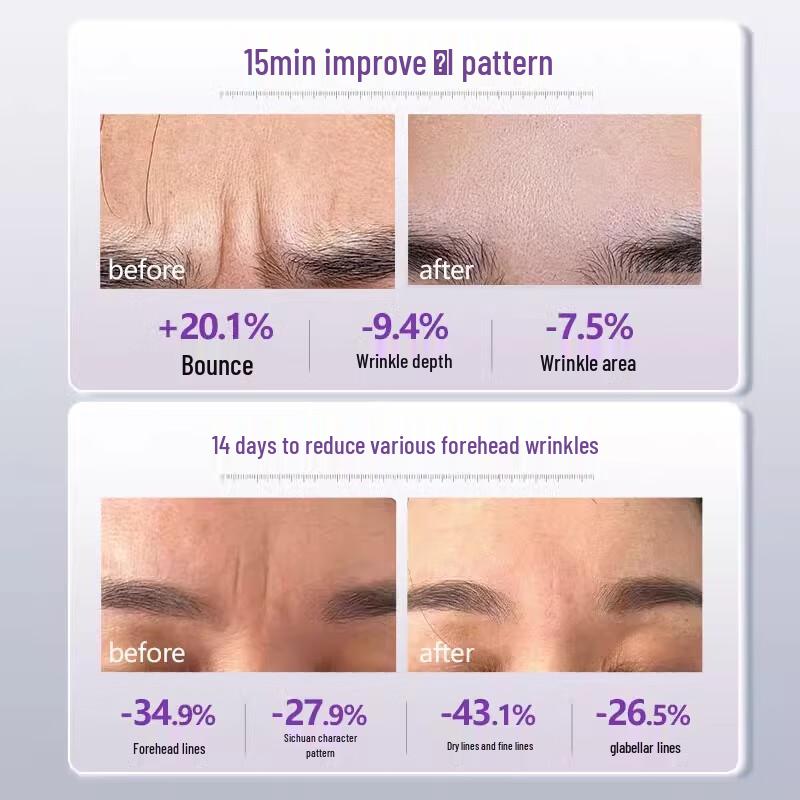 Tao Zhi Yao Yao Rynkplåster för Panna & Bekymmersrynkor