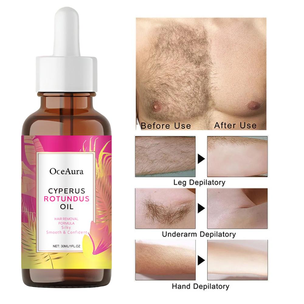 Olej z Cyperus Rotundus pro odstranění chloupků Vyhlazující Zklidňující Péče o pleť Hydratuje Podpaží Noha Ruka Inhibitor růstu chloupků Depilační olej