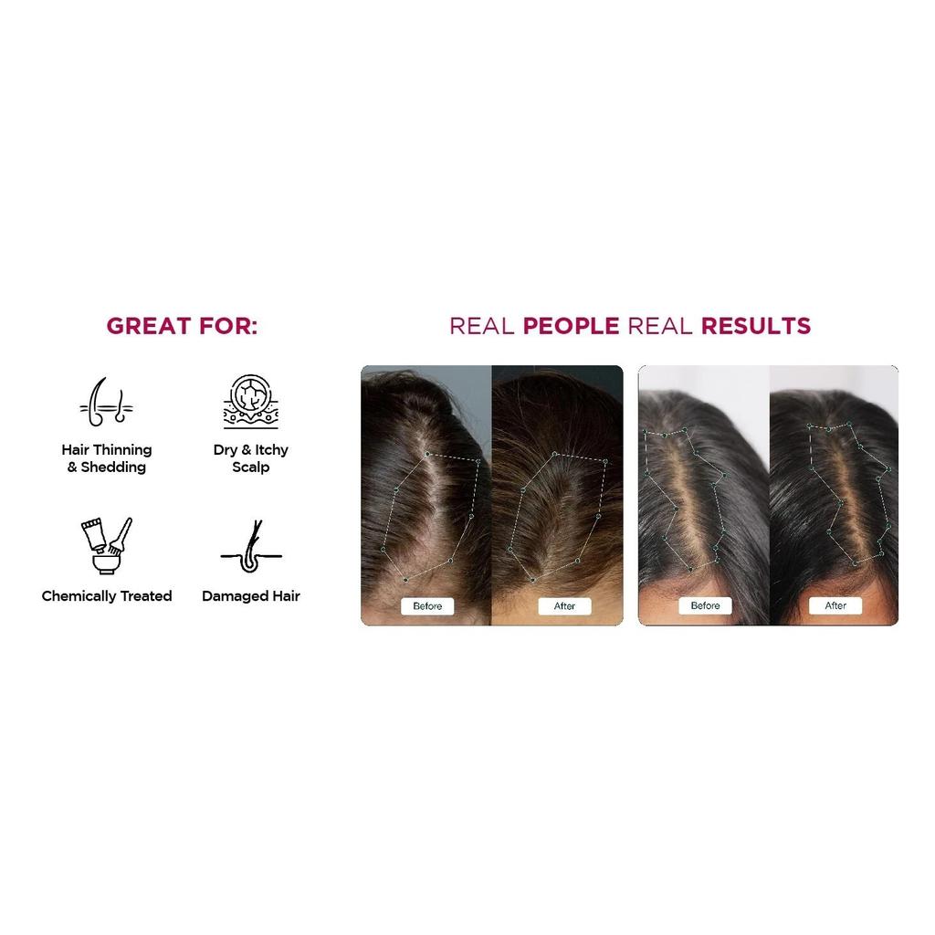 Rosemary Redensyl Hair Growth Serum & Anti Greying Booster Concentrate 30ml