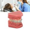Dental Orthodontic Model 28pcs Teeth Resin Dental Teaching Teeth Model with Metal Braces