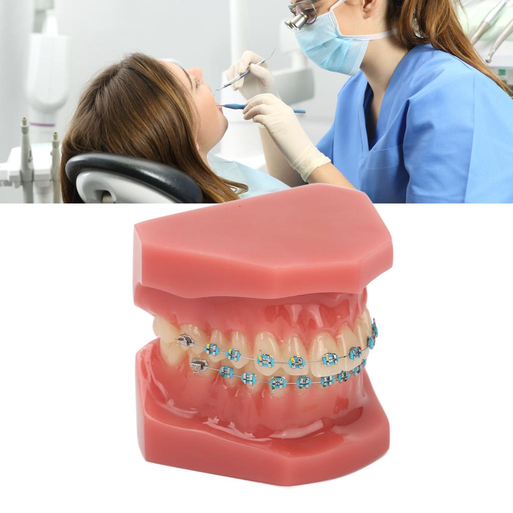 Dental Orthodontic Model 28pcs Teeth Resin Dental Teaching Teeth Model with Metal Braces