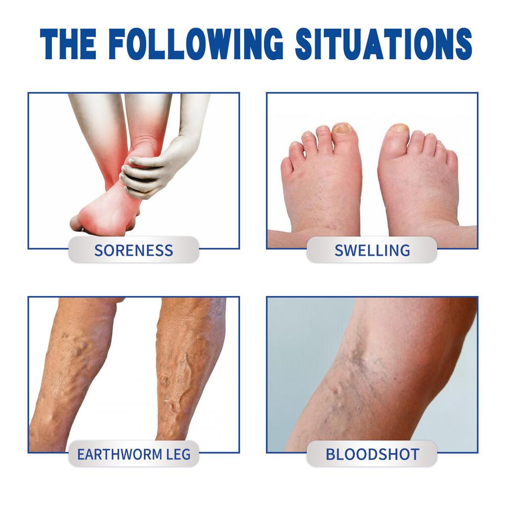 South Moon Leg Care Cream - Soothes Leg Discomfort, Deep Moisturizing Massage Cream 100g