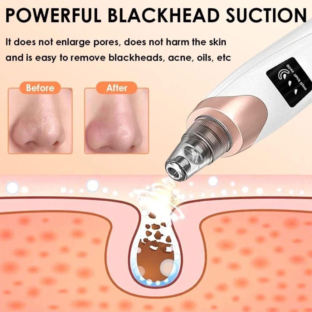 5 Suction Heads Vacuum Pore Cleaner Deep Cleansing Face Cleansing Machine  Facial Pores