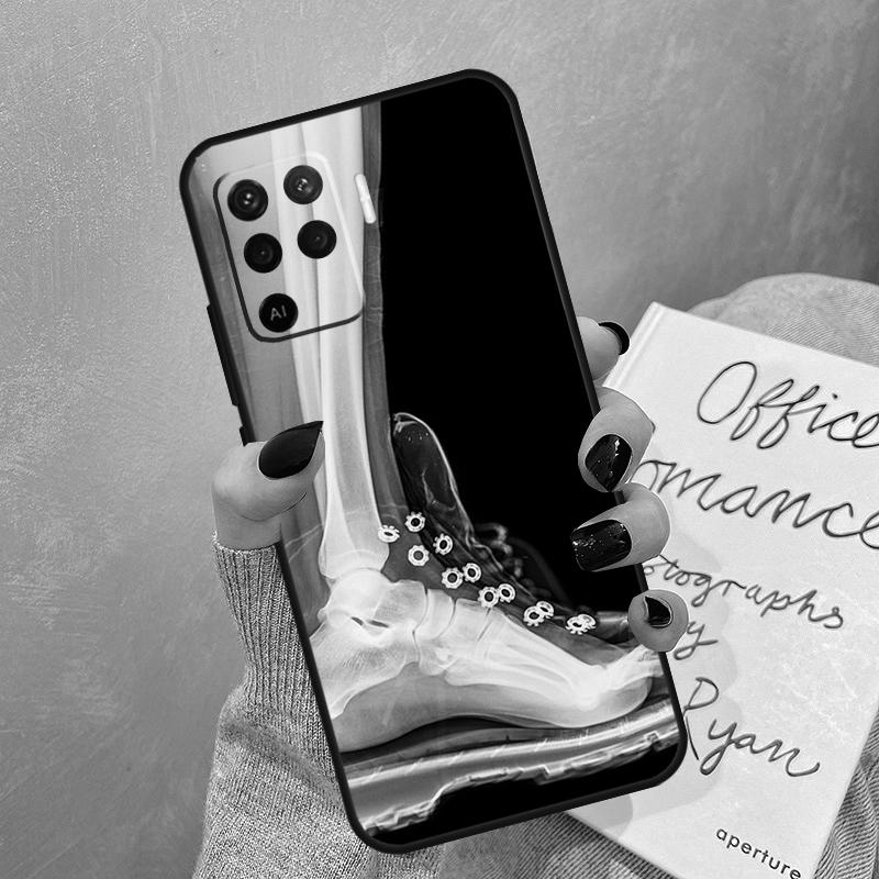 X-Ray Human Anatomy Case For Oppo A40 A60 A80 A78 A38 A18 A98 A58 A96 A76 A16 A94 A74 A54 A15 A17 A57 A77 A5 Pro