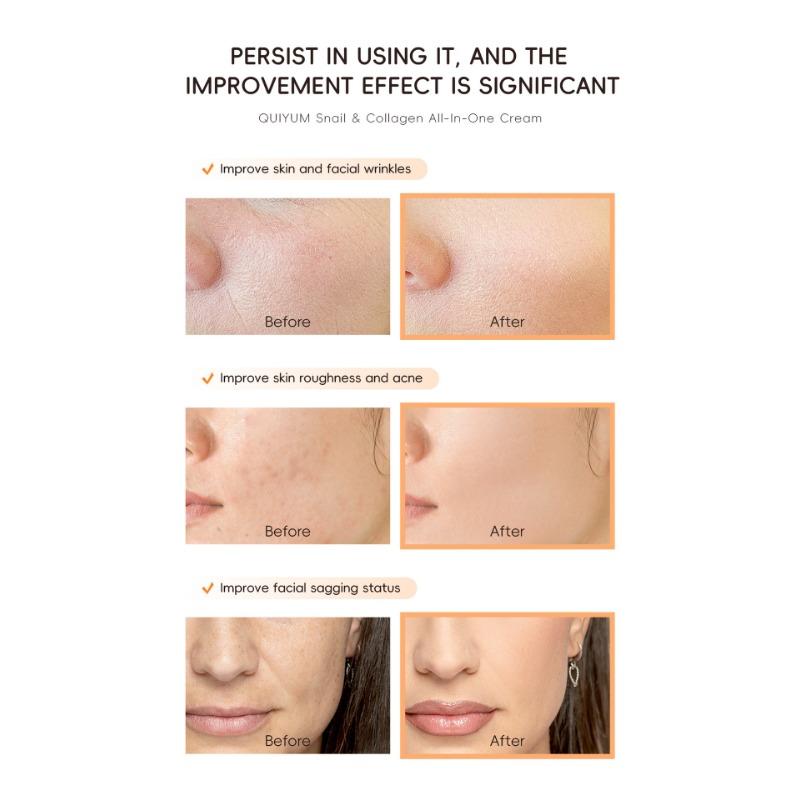 Snail Collagen All in One Serie, Hautpflege Set 3 Stück