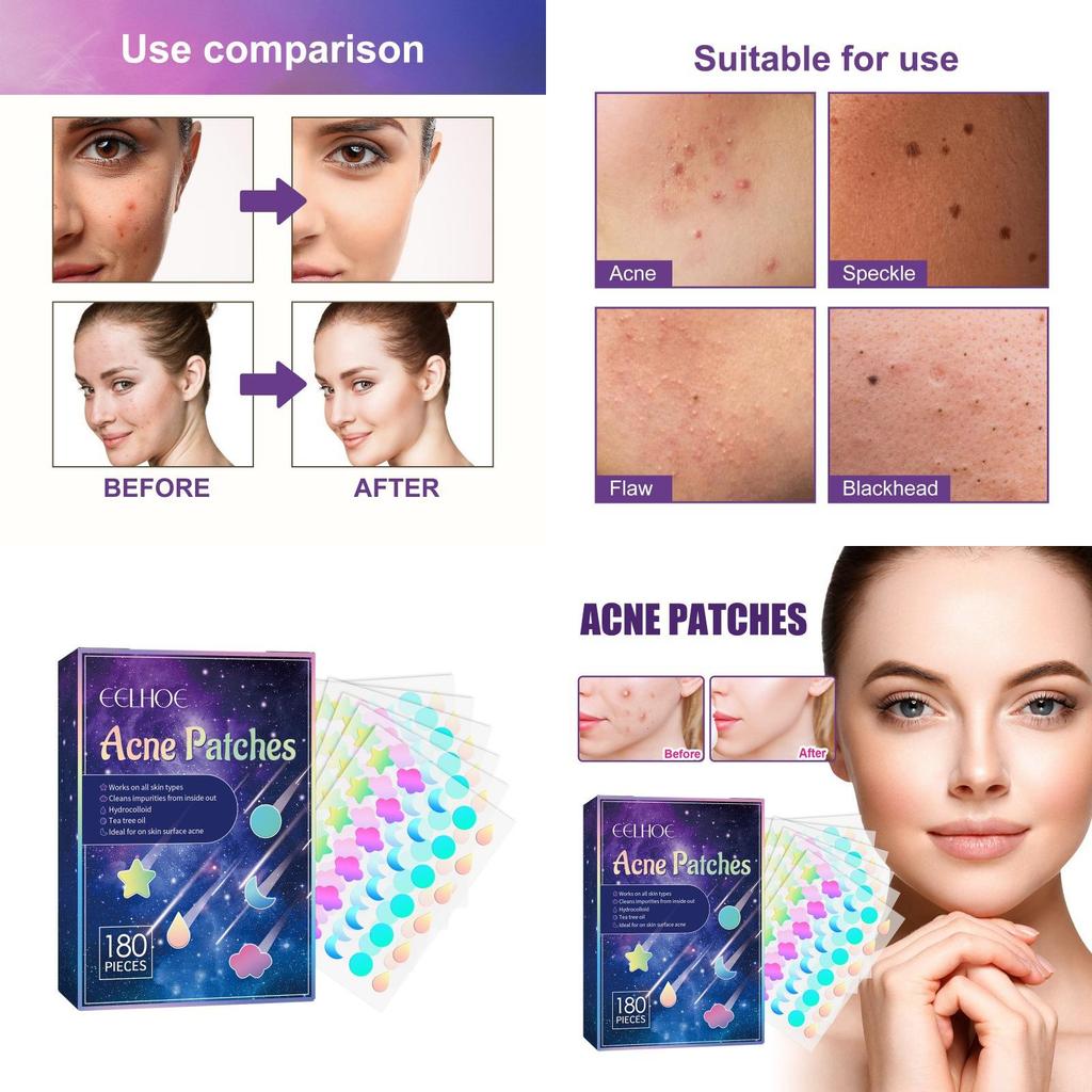 Eelhoe Pimple Patches For Effective Skin Repair And Acne Spot Treatment With 180 Pieces For Clear Complexion