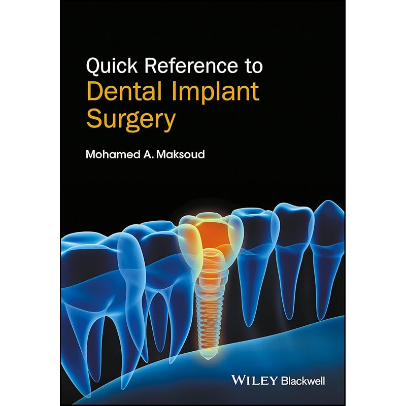Quick Reference to Dental Implant Surgery