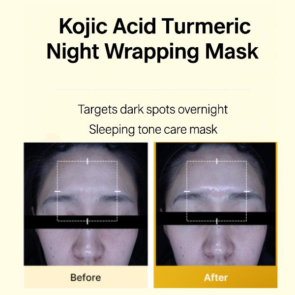 Medicube Kojisäure Kurkuma Vita Wickelmaske (75 ml) (3 Optionen)