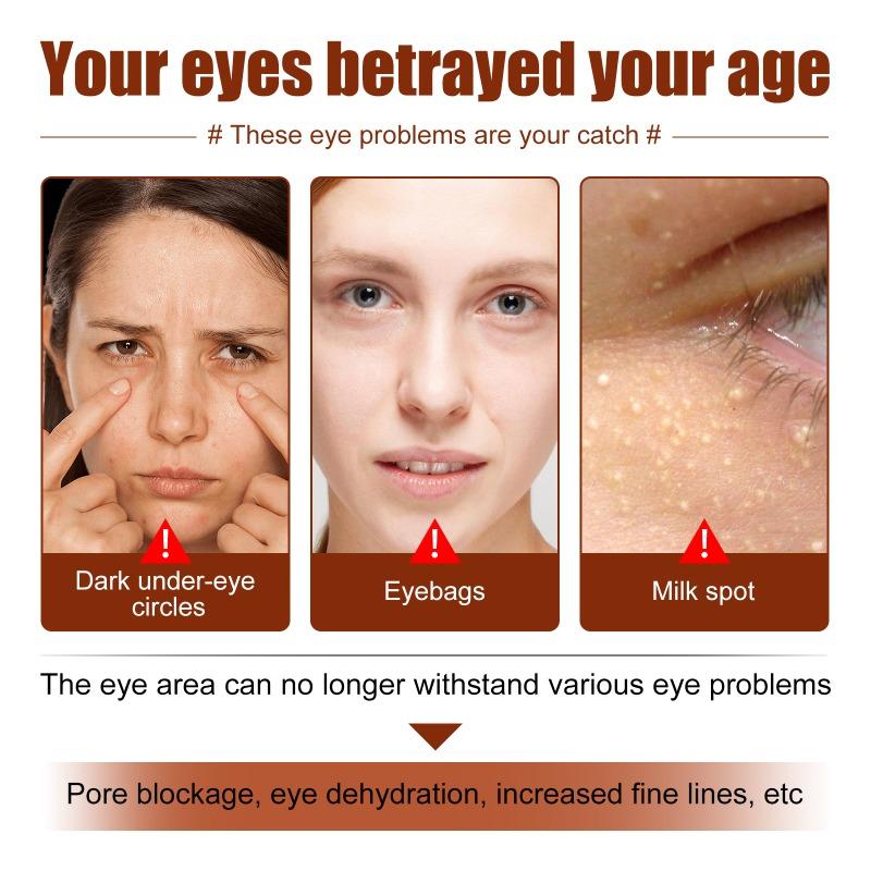 Reparação de inchaço de castanha, grãos de gordura para clarear as linhas finas dos olhos, creme nutritivo para os olhos, clareamento de rugas, creme para os olhos tensor