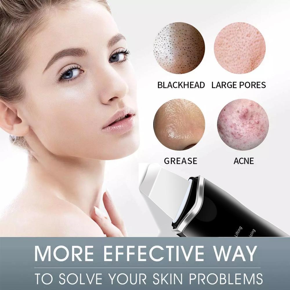 Skin Scrubber Spatula Ultrasonic Face Scrubber Facial Spatula Lifting Moisturizing Cleaning Rechargeable Beauty Tool