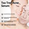 Eelhoe Green Tea Acne Serum Nourishing Antioxidant Formula For Brightening And Moisturizing