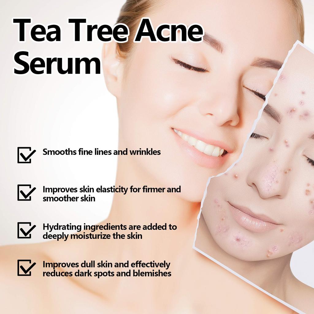 Eelhoe Green Tea Acne Serum Nourishing Antioxidant Formula For Brightening And Moisturizing