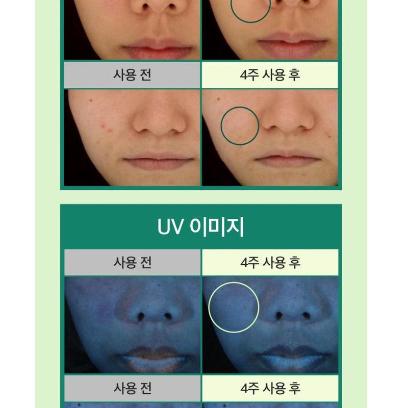 MEDIPEEL - A.C Tea Clear