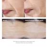MARSHIQUE - Wrinkle Repair Forehead Wrinkle Patch