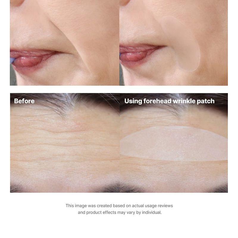 MARSHIQUE - Wrinkle Repair Forehead Wrinkle Patch