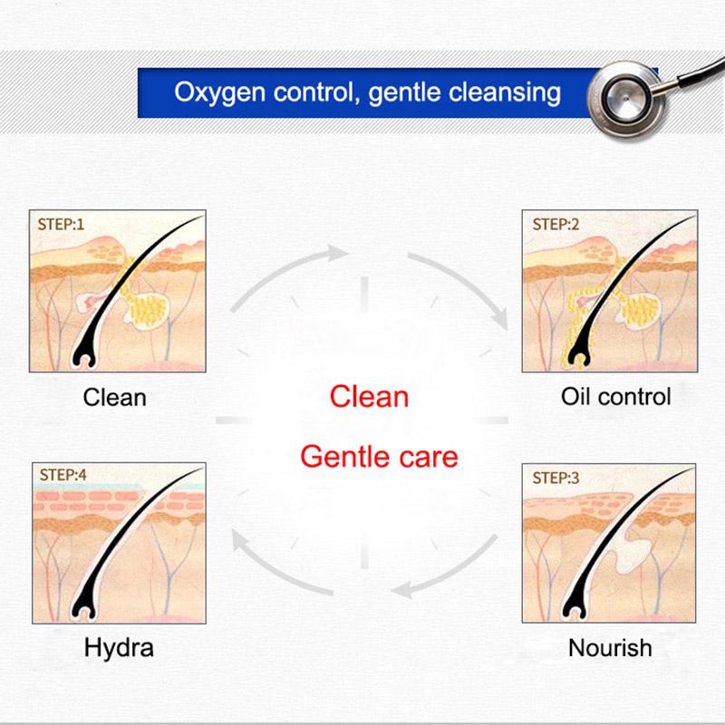 Le contrôle de l'huile élimine les points noirs d'acné nettoyant pour le visage nettoyage en profondeur traitement de l'acné soins de la peau