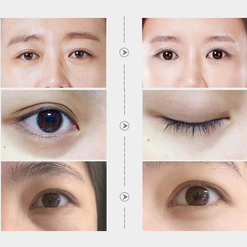 Sakura Caviar Eye Cream Moisturizing The Eye Area To Refine The Skin Refine The Fine Lines and Crow's Feet