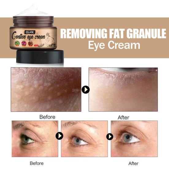 Cream Efficient Fast Absorption Non-irritating Smooth Natural Lighten Dark Circles Wide Application Gentian