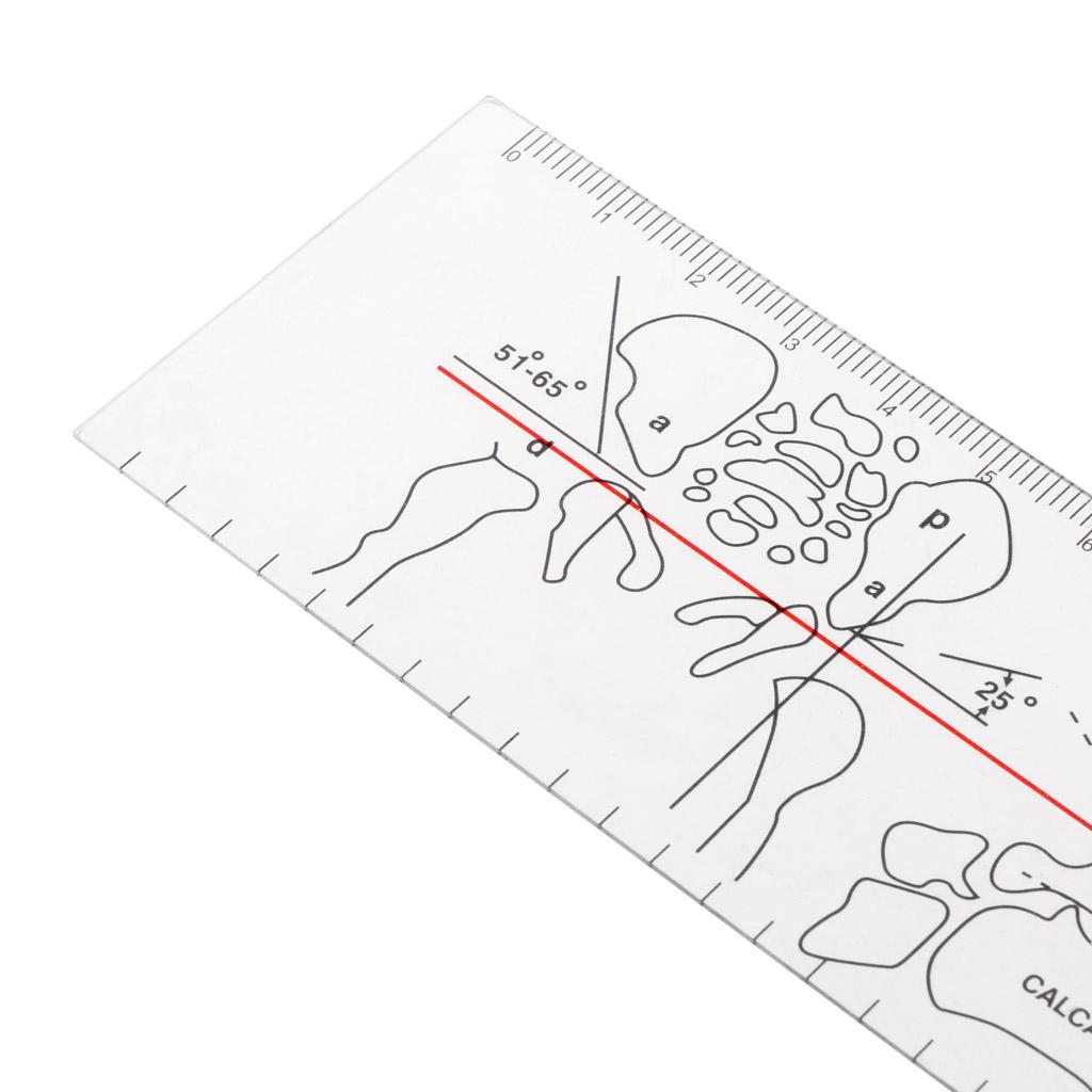 Professional Portable Orthopedic Medical Measuring Angle Ruler Suitable for Family Hospitals Orthopedics