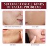 Limited time!!Oceaura Rose Hip Oil Facial Essence Fades Wrinkles Hyrating, Nourishing, Tightening, Elastic And Skin Anti-Wrinkle Essence