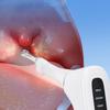 Adjustable Electric Oral Irrigator with Disinfection for Tonsil Stone Removal