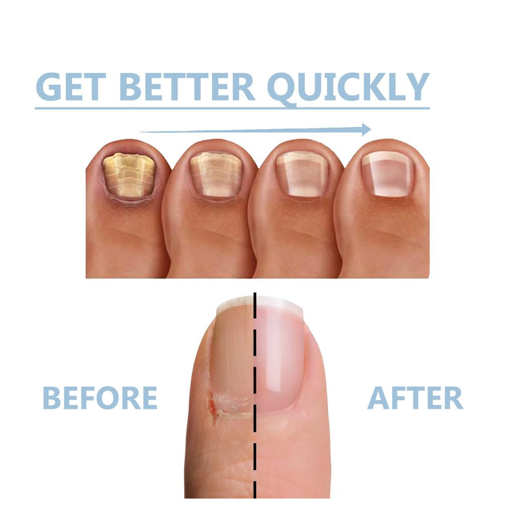 Oceaura Ongle Liquide Réparateur Exceptionnel Pour Nourrir Et Réparer Les Ongles Faibles 15ml