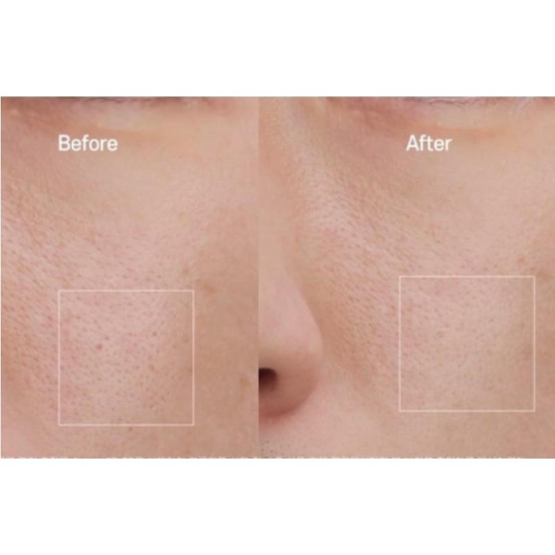 DEMAR3 SIGNATURE ESTUD PROTECTOR 5.2 30ml / Pore Ampoule