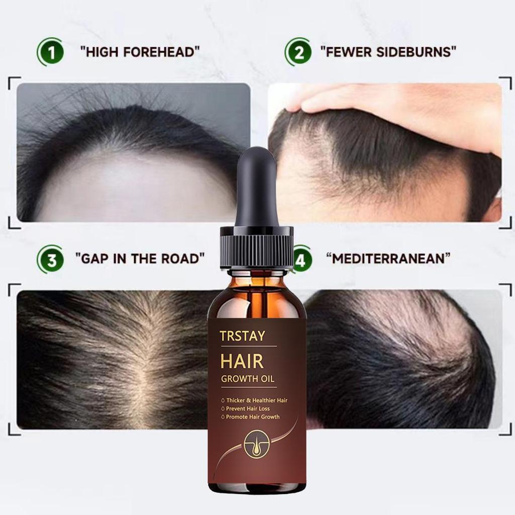 5G/15G/30G/50G/ Aide à réparer les tissus fibreux et à restaurer la vitalité des cheveux. Contient des nutriments