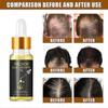 New model Eelhoe Hair Care Essential Oil Kit -6437638963591