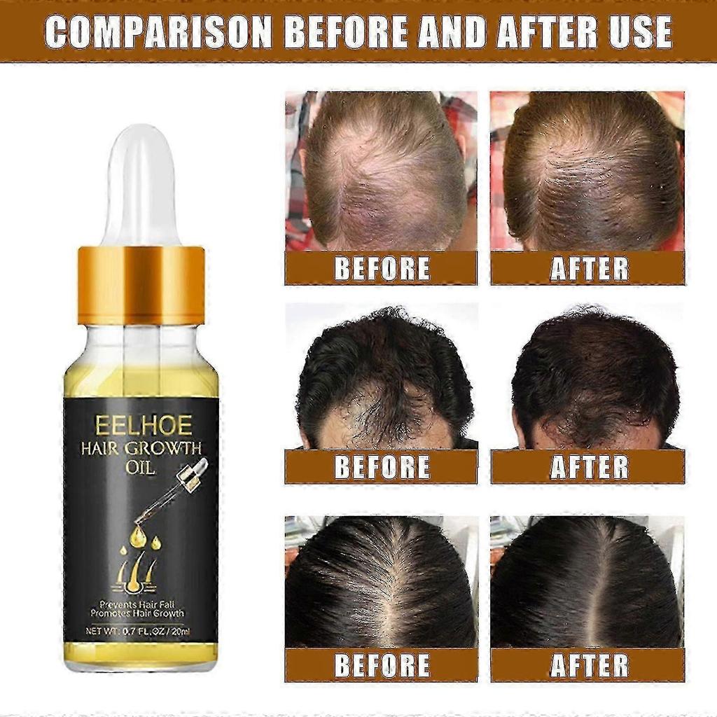 New model Eelhoe Hair Care Essential Oil Kit -6437638963591