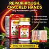 Soothing Herbal Cream for Dry Cracked Hands & Chilblains – Long-Lasting Moisture for Winter Care