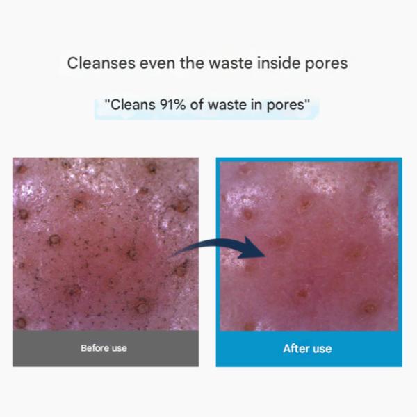 TORRIDEN DIVE-IN Low Molecular Hyaluronic Acid Cleansing Foam (150ml / 5.07 Fl.oz.) (3 Options)