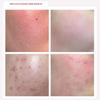 Rdrd Red Apple Lacto Calming Popping Toner 95g