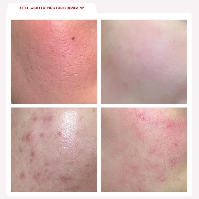 Rdrd Red Apple Lacto Calming Popping Toner 95g