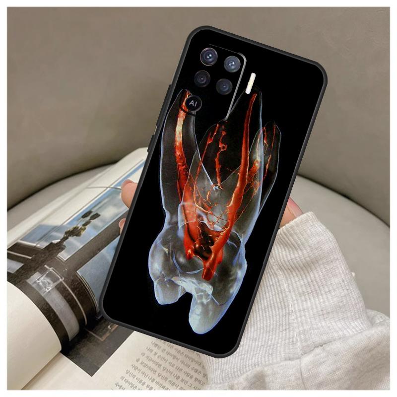 Human Tooth Anatomy Case For Oppo A74 A94 A54 A18 A38 A58 A78 A98 A80 A60 A40 A96 A76 A16 A15 A17 A57 A77 A5 Pro