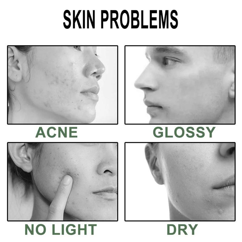 1 Pezzo Maschera Viso Tè Verde Olio Argilla Purificante Stick Controllo Sebo Melanzana Anti-Acne Maschera Solida