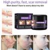 Scar Repair Cream Desalt Postoperative Scars, Smooth Skin, Repair Skin Wounds, Moisturize Skin Care Cream