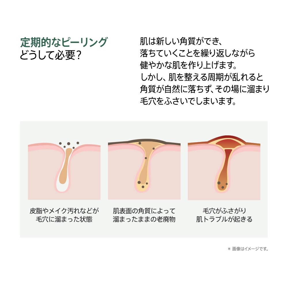 ANUA Houttuynia Cordata LHA Moisture Peeling Gel Pore Blackhead Combination Heartleaf Peeling Facial Korean Cosmetics 120ml, Gommage, Cleansing,