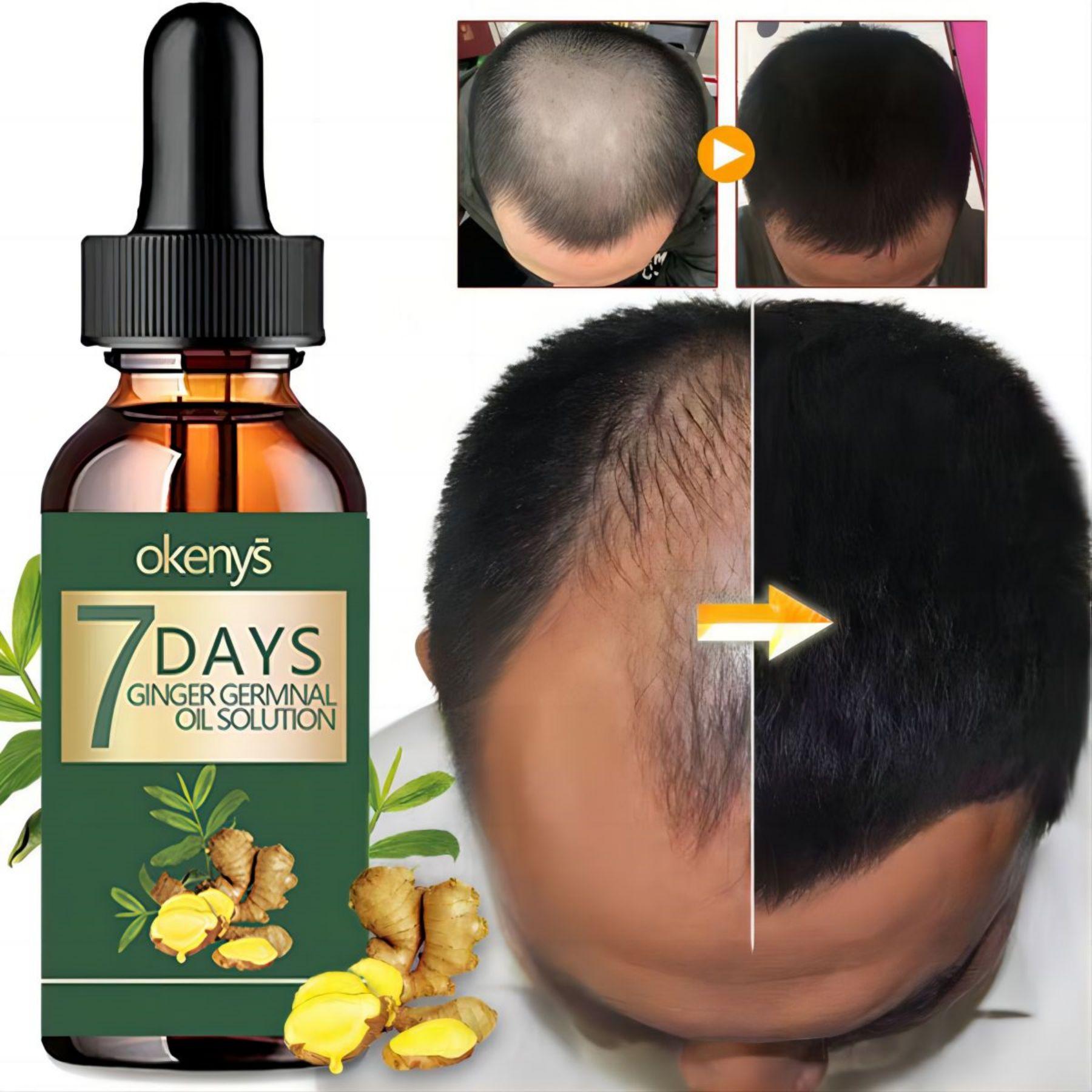 

Hair Growth Products Ginger Fast Grow Eyebrow Care Essential Oil Prevent Men Women Hair Loss Treatment Liquid 30ml