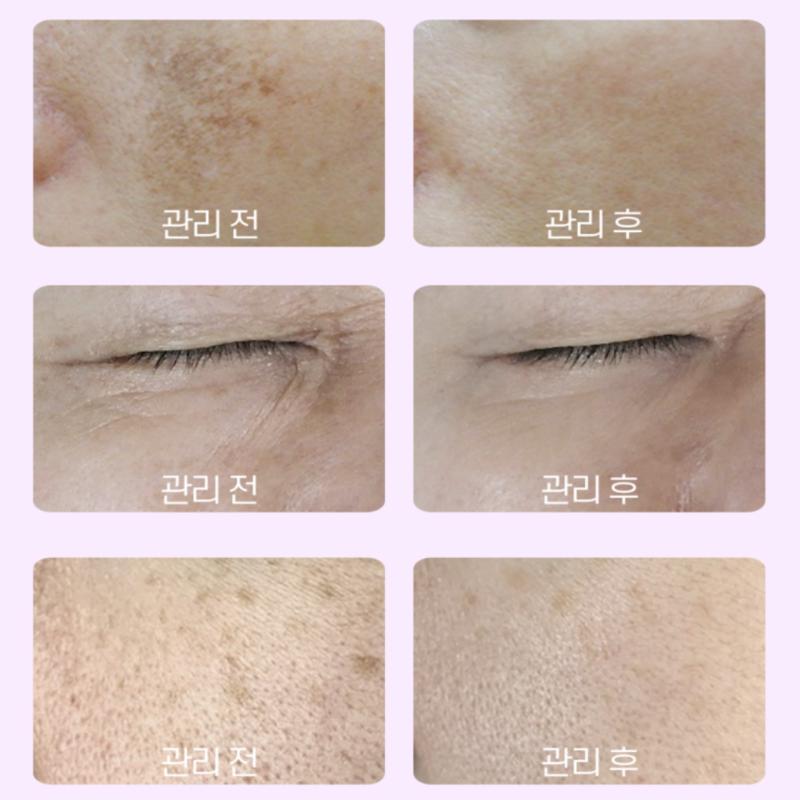 [RXDERMA] Whitening VitaA Cream Retinal 1300ppm 20g