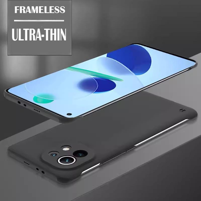 

Твердый чехол-накладка из твердого ПК цвета конфет без рамки для Xiaomi Mi 11 Lite Coque 11T 11 Ultra Pro, ударопрочный, ультратонкий чехол Mi 11 Ultra чёрный