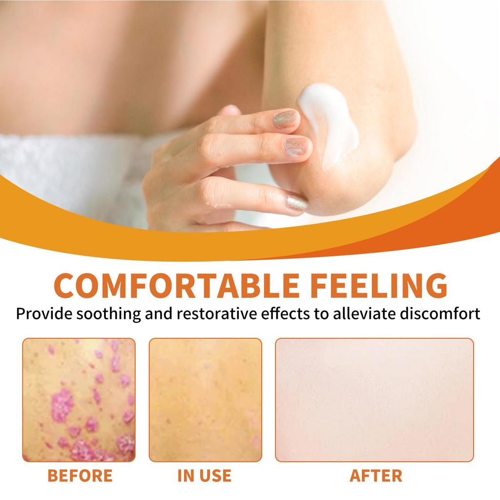 30g Bee Venom Body Cream Body Skin Nourishing Moisturizing Discomfort Relieving Care Daily Massage Applicator Cream