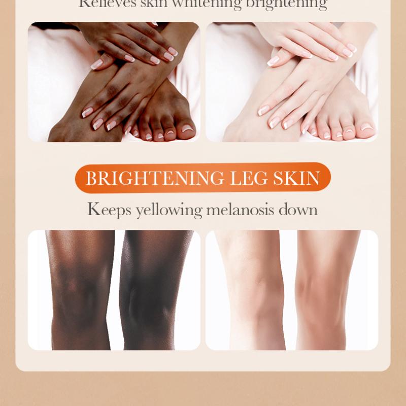 Joint Whitening and Blackening Cream 140g SADOER Vitamin C Moisturizing Body Lotion