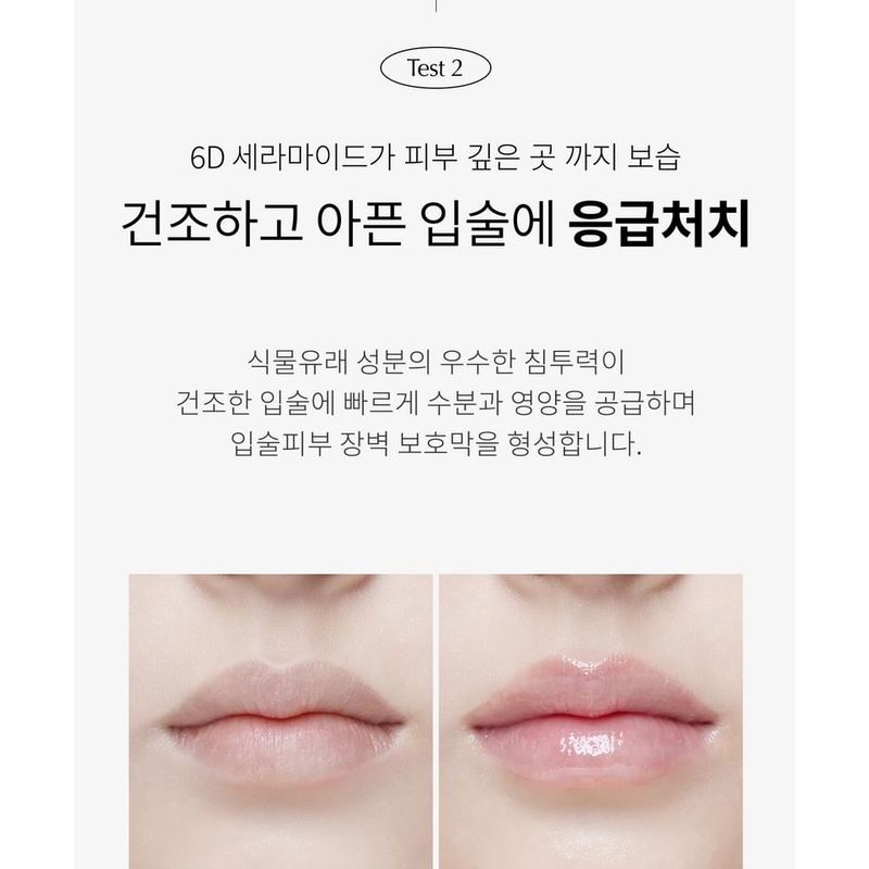 FORETDERM - 119 Peptid Lippenpflege