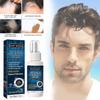 East Moon Men's Hair Growth Spray For Thicker Hairline And Prevents Hair Loss