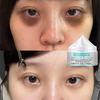 Nstant Remove Eye Bags Cream Retinol Cream Anti Puffiness Gel Dark Circles Delays Aging Fades Wrinkles Firming Brighten