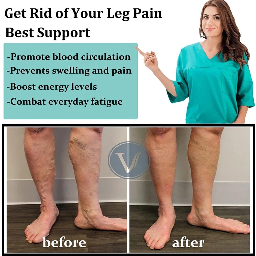 1 Paar Sport Koperen Compressiekousen Voor Vrouwen En Mannen, Circulatie 15-20 Mmhg Is Beste Ondersteuning Voor De Hele Dag Dragen Hardlopen Verpleegkundige